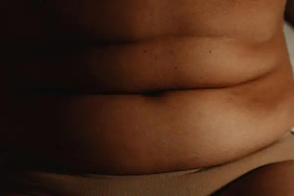 The Hidden Connection: How Stress Shapes Your Fitness and Body Composition 3 image of what stress can do on the stomach area and how Lipo 360 England can help to change your body shape.