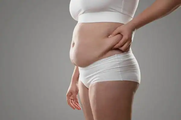 Image of stress belly England How Lipo 360 can help manage your symptoms